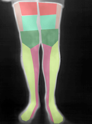 legs-front