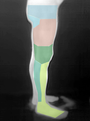 legs-side